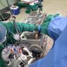 Bomba de circulacion extracorporea