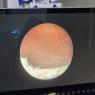 Pantalla de un sistema de endoscopia de alta definición