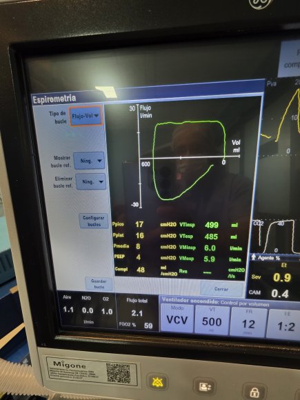 Ventilador mecánico configurado en el modo VCV